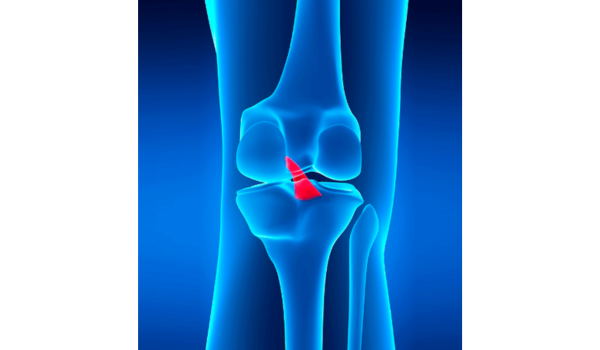 Ligamento Cruzado Anterior